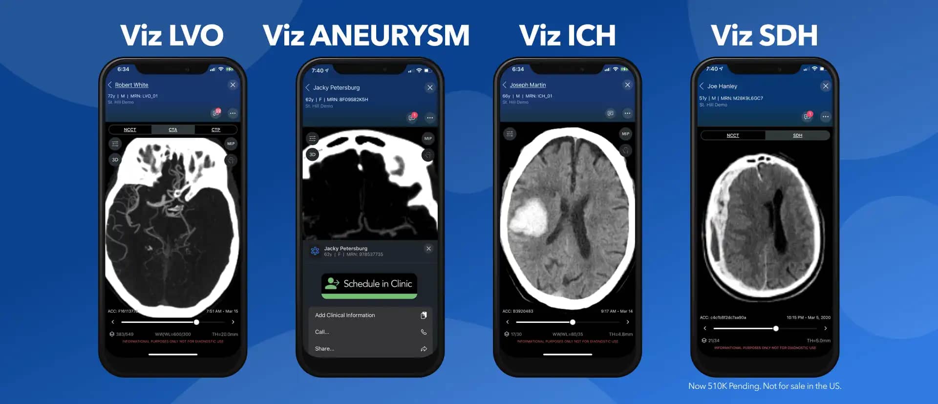 Viz.ai